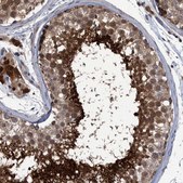Anti-PCYT2 antibody produced in rabbit Prestige Antibodies&#174; Powered by Atlas Antibodies, affinity isolated antibody, buffered aqueous glycerol solution, Ab1