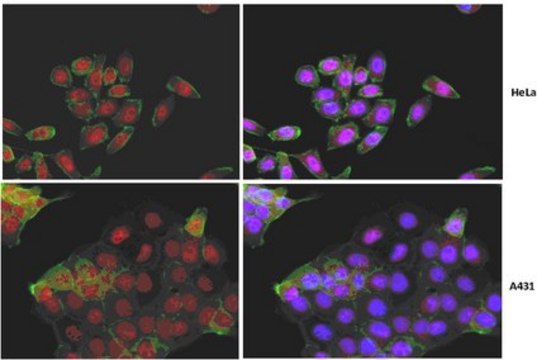 Anti-Yes-associated protein (YAP1) Antibody, clone 4D11.1 clone 4D11.1, from mouse