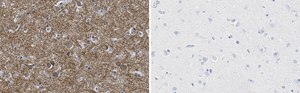 Anti-K+/Cl- Cotransporter-2 Antibody, clone 5E13 ZooMAb&#174; Rabbit Monoclonal recombinant, expressed in HEK 293 cells