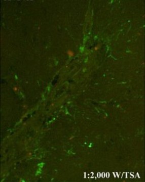 Anti-CHI3L1 affinity isolated antibody