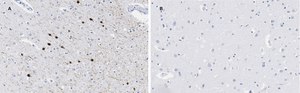 Anti-Calretinin Antibody, clone 3K22, ZooMAb&#174; Rabbit Monoclonal recombinant, expressed in HEK 293 cells