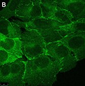 Anti-PARD-3 Antibody, clone 1N18 ZooMAb&#174; Rabbit Monoclonal recombinant, expressed in HEK 293 cells