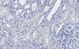 Anti-Jagged1 Antibody, clone 1C23 ZooMAb&#174; Rabbit Monoclonal recombinant, expressed in HEK 293 cells