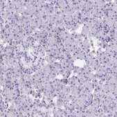 Anti-DBN1 antibody produced in rabbit Prestige Antibodies&#174; Powered by Atlas Antibodies, affinity isolated antibody, buffered aqueous glycerol solution