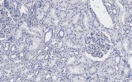 Anti-53BP1 Antibody, clone 1H16 ZooMAb&#174; Rabbit Monoclonal recombinant, expressed in HEK 293 cells