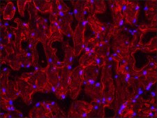 Anti-Dysferlin (N-terminal) antibody produced in rabbit ~1.0&#160;mg/mL, affinity isolated antibody, antigen mol wt ~250&#160;kDa