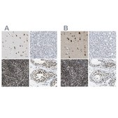 Anti-FOXK1 antibody produced in rabbit Prestige Antibodies&#174; Powered by Atlas Antibodies, affinity isolated antibody, buffered aqueous glycerol solution