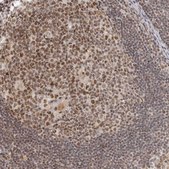 Anti-MSH6 antibody produced in rabbit Prestige Antibodies&#174; Powered by Atlas Antibodies, affinity isolated antibody, buffered aqueous glycerol solution, ab2
