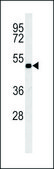 ANTI-KCNV1 (N-TERM) antibody produced in rabbit IgG fraction of antiserum, buffered aqueous solution