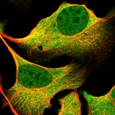 Anti-LTV1 antibody produced in rabbit Prestige Antibodies&#174; Powered by Atlas Antibodies, affinity isolated antibody, buffered aqueous glycerol solution, ab1