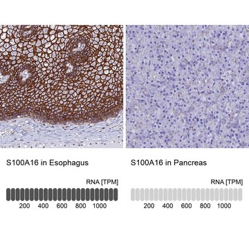 Anti-S100A16 antibody produced in rabbit Prestige Antibodies&#174; Powered by Atlas Antibodies, affinity isolated antibody, buffered aqueous glycerol solution