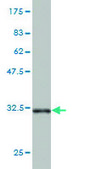 Monoclonal Anti-AK3 antibody produced in mouse clone 1D2, purified immunoglobulin, buffered aqueous solution