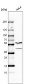 Anti-PAPD7 antibody produced in rabbit Prestige Antibodies&#174; Powered by Atlas Antibodies, affinity isolated antibody, buffered aqueous glycerol solution