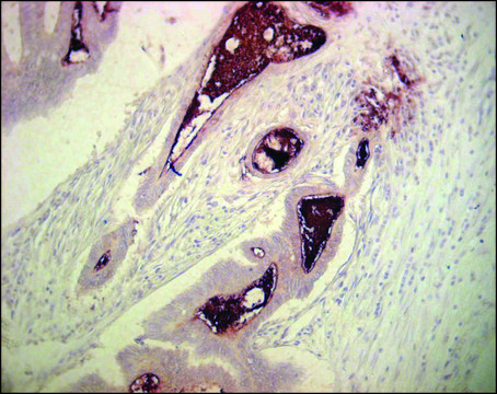 Monoclonal Anti-Carcinoembryonic Antigen antibody produced in mouse clone C6G9, ascites fluid