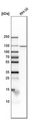 Anti-IPO7 antibody produced in rabbit Prestige Antibodies&#174; Powered by Atlas Antibodies, affinity isolated antibody, buffered aqueous glycerol solution