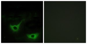 Anti-CALR antibody produced in rabbit affinity isolated antibody