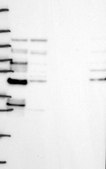 Anti-LSR antibody produced in rabbit Prestige Antibodies&#174; Powered by Atlas Antibodies, affinity isolated antibody, buffered aqueous glycerol solution