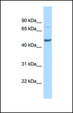 Anti-CBX8, (N-terminal) antibody produced in rabbit affinity isolated antibody
