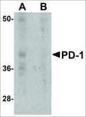 Monoclonal Anti-PD-1 antibody produced in mouse clone 7A11B1, purified immunoglobulin, buffered aqueous solution