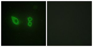 Anti-Actinin &#945; antibody produced in rabbit affinity isolated antibody