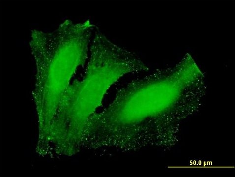 Anti-NETO2 antibody produced in mouse purified immunoglobulin, buffered aqueous solution
