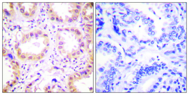 Anti-NEDD8 antibody produced in rabbit affinity isolated antibody