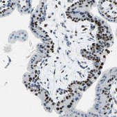 Anti-MCM3 antibody produced in rabbit Ab2, Prestige Antibodies&#174; Powered by Atlas Antibodies, affinity isolated antibody, buffered aqueous glycerol solution