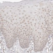 Anti-INTS11 antibody produced in rabbit Prestige Antibodies&#174; Powered by Atlas Antibodies, affinity isolated antibody, buffered aqueous glycerol solution