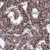 Anti-FTO antibody produced in rabbit Prestige Antibodies&#174; Powered by Atlas Antibodies, affinity isolated antibody