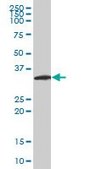 Monoclonal Anti-NEUROG2 antibody produced in mouse clone 2A8, purified immunoglobulin, buffered aqueous solution