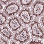 Anti-UBN1 antibody produced in rabbit Prestige Antibodies&#174; Powered by Atlas Antibodies, affinity isolated antibody, buffered aqueous glycerol solution