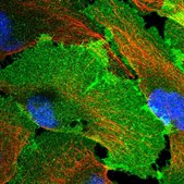 Anti-GNB4 antibody produced in rabbit Prestige Antibodies&#174; Powered by Atlas Antibodies, affinity isolated antibody, buffered aqueous glycerol solution