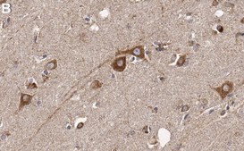 Anti-EphA2 Antibody, clone 2C3 ZooMAb&#174; Rabbit Monoclonal recombinant, expressed in HEK 293 cells