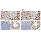 Anti-MAP7 antibody produced in rabbit Prestige Antibodies&#174; Powered by Atlas Antibodies, affinity isolated antibody, buffered aqueous glycerol solution, ab1