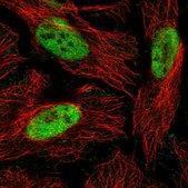 Anti-RBBP4 antibody produced in rabbit Prestige Antibodies&#174; Powered by Atlas Antibodies, affinity isolated antibody, buffered aqueous glycerol solution