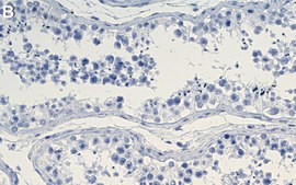 Anti-DEPDC5 Antibody, clone 1G17 ZooMAb&#174; Rabbit Monoclonal recombinant, expressed in HEK 293 cells