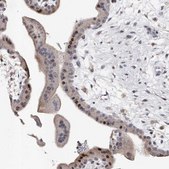 Anti-RWDD2A antibody produced in rabbit Prestige Antibodies&#174; Powered by Atlas Antibodies, affinity isolated antibody, buffered aqueous glycerol solution, ab2