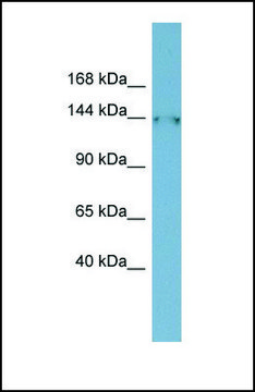 Anti-FAM135B antibody produced in rabbit affinity isolated antibody