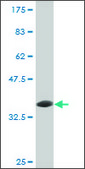Monoclonal Anti-UBE3A antibody produced in mouse clone 3E5, purified immunoglobulin, buffered aqueous solution