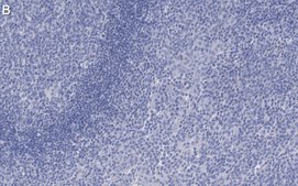 Anti-Cytokeratin 5/6 Antibody, clone D5/16 B4 ZooMAb&#174; Mouse Monoclonal recombinant, expressed in HEK 293 cells
