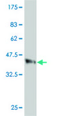 Monoclonal Anti-CLTC antibody produced in mouse clone 2E5, purified immunoglobulin, buffered aqueous solution