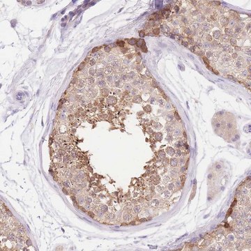 Anti-LIPH antibody produced in rabbit Prestige Antibodies&#174; Powered by Atlas Antibodies, affinity isolated antibody, buffered aqueous glycerol solution