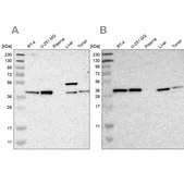 Anti-SERPINB6 antibody produced in rabbit Prestige Antibodies&#174; Powered by Atlas Antibodies, affinity isolated antibody, buffered aqueous glycerol solution
