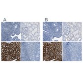 Anti-ASGR1 antibody produced in rabbit Prestige Antibodies&#174; Powered by Atlas Antibodies, affinity isolated antibody, buffered aqueous glycerol solution