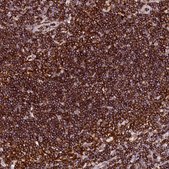 Anti-AAAS antibody produced in rabbit Prestige Antibodies&#174; Powered by Atlas Antibodies, affinity isolated antibody, buffered aqueous glycerol solution