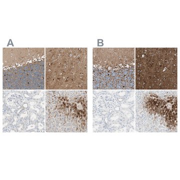 Anti-GLUL antibody produced in rabbit Ab2, Prestige Antibodies&#174; Powered by Atlas Antibodies, affinity isolated antibody, buffered aqueous glycerol solution