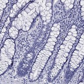 Anti-EPX antibody produced in rabbit Prestige Antibodies&#174; Powered by Atlas Antibodies, affinity isolated antibody, buffered aqueous glycerol solution