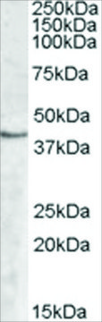 Anti-SPHK1 antibody produced in goat affinity isolated antibody, buffered aqueous solution