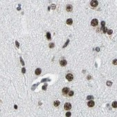 Anti-BCLAF1 antibody produced in rabbit Prestige Antibodies&#174; Powered by Atlas Antibodies, affinity isolated antibody, buffered aqueous glycerol solution