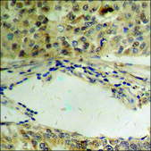 Anti-phospho-MEF2A (pThr319) antibody produced in rabbit affinity isolated antibody